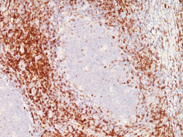 Formalin-fixed, paraffin-embedded Tonsil stained with CD6 Monoclonal Antibody (SPM547)