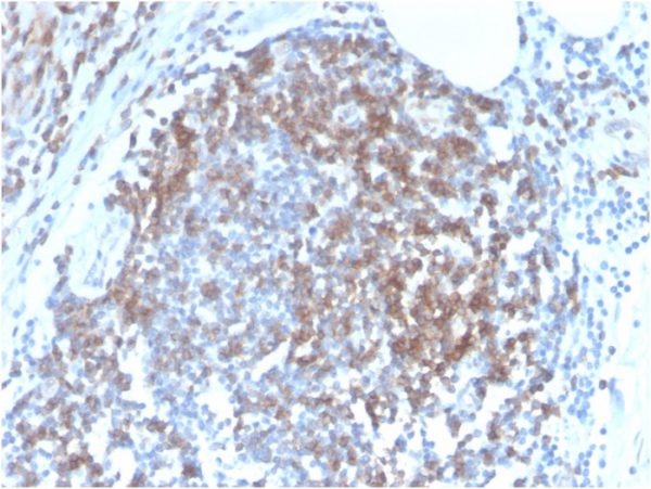 Formalin-fixed, paraffin-embedded human Tonsil stained with CD6 Rabbit Recombinant Monoclonal Antibody (C6/2884R).