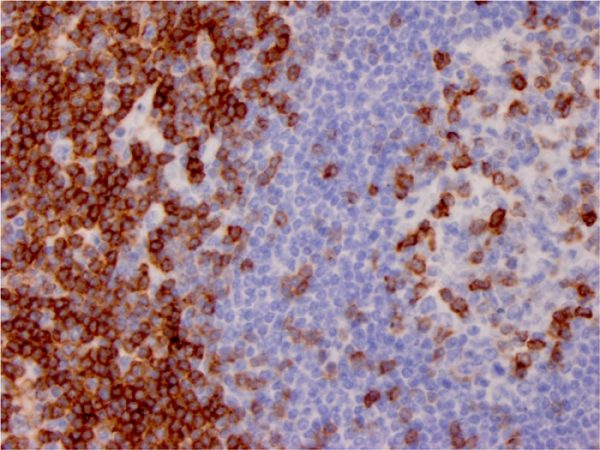 Formalin-fixed, paraffin-embedded human lymph node stained with CD7 Mouse Monoclonal Antibody (CD7/3737).