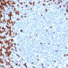 Recombinant CD7 (T-Cell Leukemia Marker) Antibody