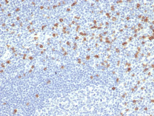 Formalin-fixed, paraffin-embedded human tonsil stained with CD8 Recombinant Mouse Monoclonal Antibody (rCD8/6590).