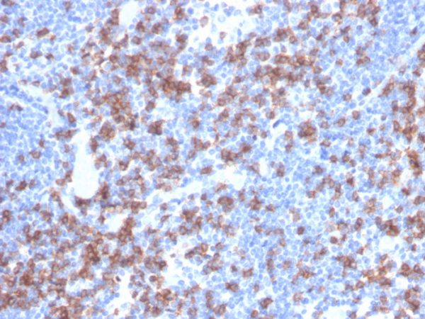 Formalin-fixed, paraffin-embedded human lymph node stained with CD8a Recombinant Mouse Monoclonal Antibody (rCD8/6590).