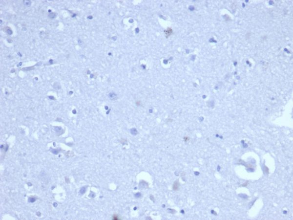 IHC analysis of formalin-fixed, paraffin-embedded human brain. Negative tissue control using rCD8/6590 at 2ug/ml in PBS for 30min RT. HIER: Tris/EDTA, pH9.0, 45min. 2 °: HRP-polymer, 30min. DAB, 5min.