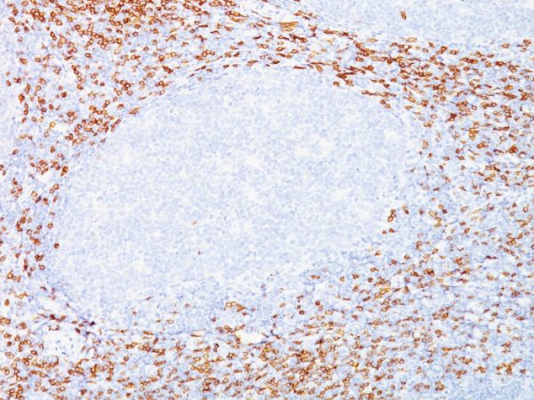 Formalin-fixed, paraffin-embedded human Tonsil stained with CD8 Mouse Monoclonal Antibody (C8/468 + C8/144B).