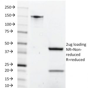 SDS-PAGE Analysis of Purified CD8A Mouse Monoclonal Antibody (C8/1035). Confirmation of Integrity and Purity of Antibody.