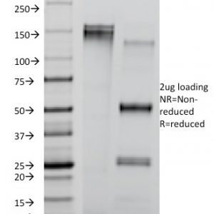 SDS-PAGE Analysis of Purified CD8A Mouse Monoclonal Antibody (RIV11). Confirmation of Integrity and Purity of Antibody.