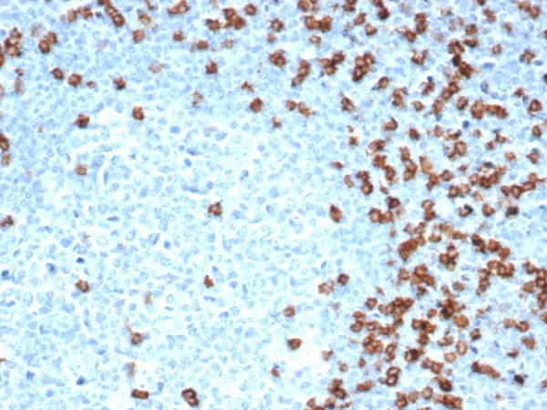 Formalin-fixed, paraffin-embedded human tonsil stained with CD8a Recombinant Rabbit Monoclonal Antibody (CD8/4391R).