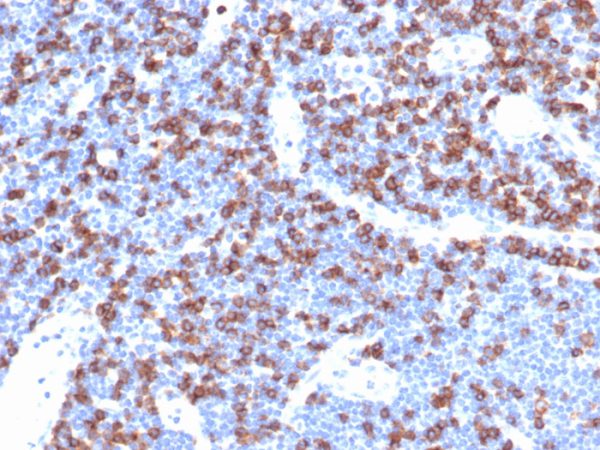 Formalin-fixed, paraffin-embedded human lymph node stained with CD8a Recombinant Rabbit Monoclonal Antibody (CD8/4391R).