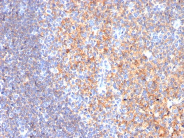 CD19 (B-Lymphocyte Marker) Antibody - Image 2