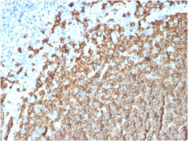 CD20 Antibody in Immunohistochemistry (IHC (P))