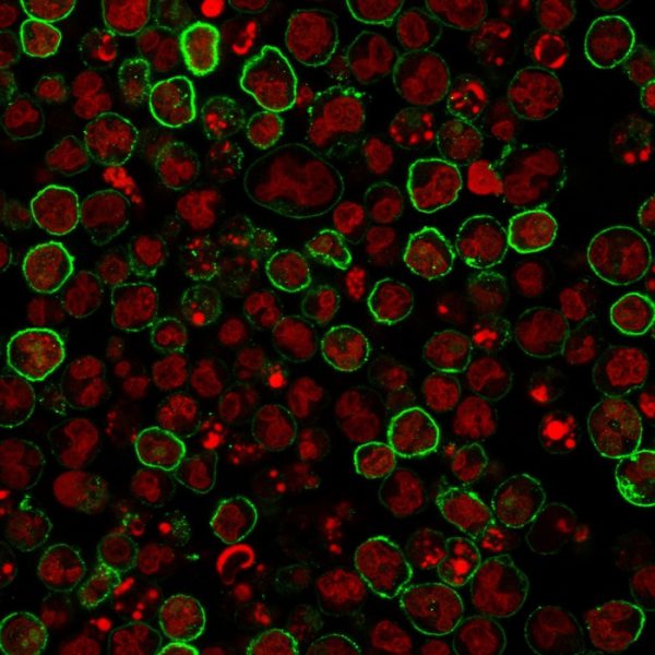 CD20 / MS4A1 (B-Cell Marker) Antibody - Image 6