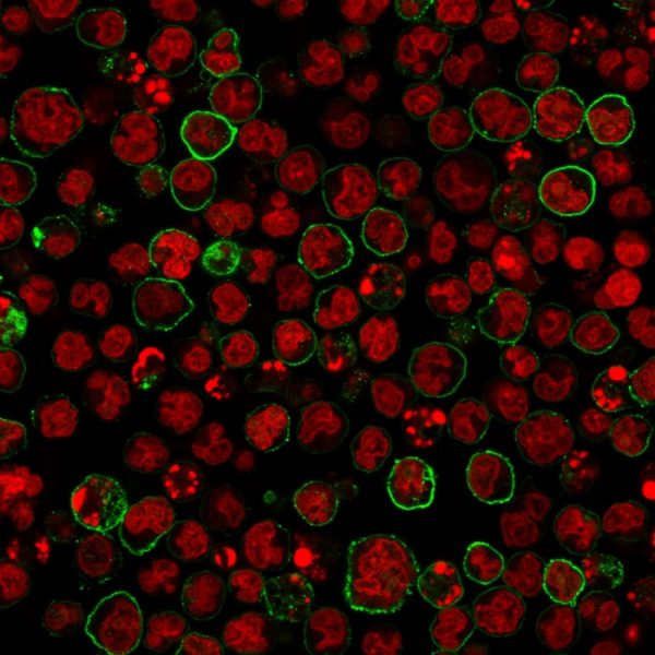 CD20 / MS4A1 (B-Cell Marker) Antibody - Image 3