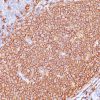 CD20 / MS4A1 (B-Cell Marker) Antibody