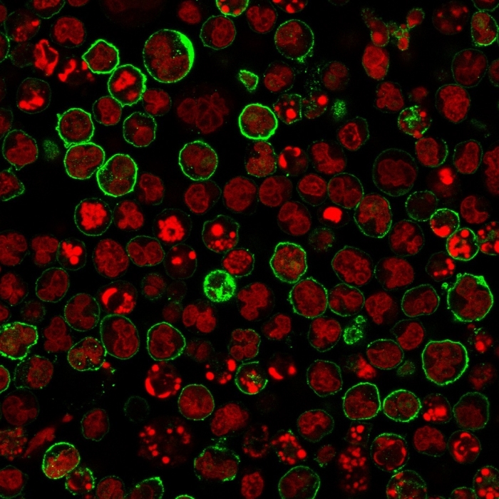 CD20 / MS4A1 (B-Cell Marker) Antibody - Clone L26 + IGEL/773 - Gene ID 931