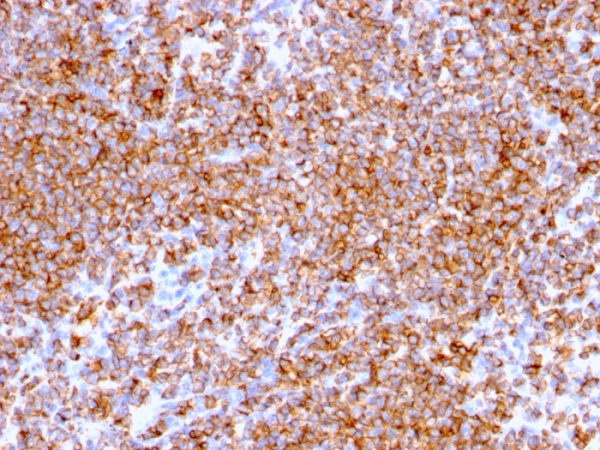 Recombinant CD20/ MS4A1 (B-Cell Marker) Antibody - Image 2