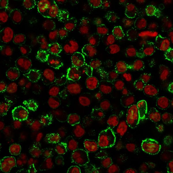 Recombinant CD20/ MS4A1 (B-Cell Marker) Antibody - Image 5