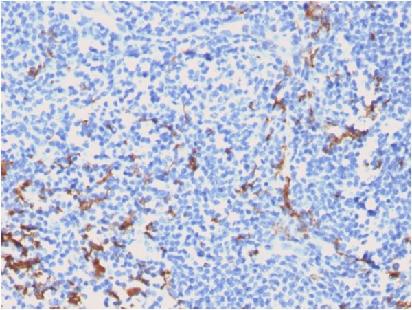 Formalin-fixed, paraffin-embedded human Tonsil stained with CD163-Monospecific Mouse Monoclonal Antibody (M130/2162).