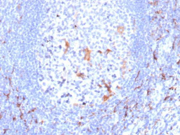 Formalin-fixed, paraffin-embedded human tonsil stained with CD163 Mouse Monoclonal Antibody (M130/2163).