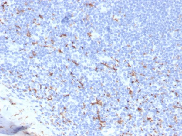 Formalin-fixed, paraffin-embedded human tonsil stained with CD163 Recombinant Rabbit Monoclonal Antibody (M130/3708R). HIER: Tris/EDTA, pH9.0, 45min. 2: HRP-polymer, 30min. DAB, 5min.