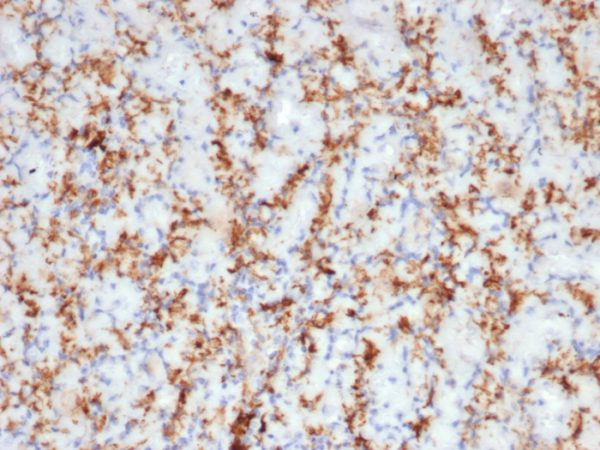 Formalin-fixed, paraffin-embedded human spleen stained with CD163 Recombinant Rabbit Monoclonal Antibody (M130/3708R). HIER: Tris/EDTA, pH9.0, 45min. 2: HRP-polymer, 30min. DAB, 5min.