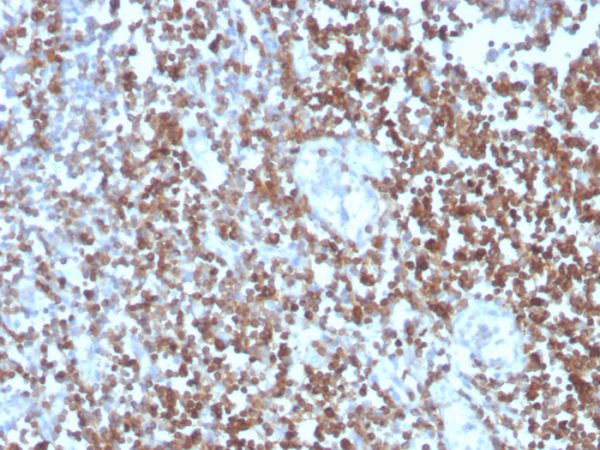 Formalin-fixed, paraffin-embedded human tonsil stained with CD27 Mouse Monoclonal Antibody (LPFS2/4177).