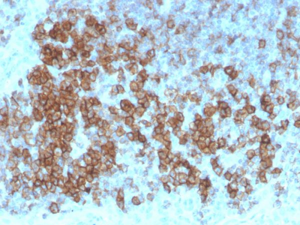 CD27 (Tumor Necrosis Factor Receptor Superfamily 7) Antibody