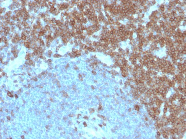 CD27 (Tumor Necrosis Factor Receptor Superfamily 7) Antibody - Image 2