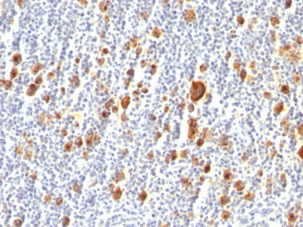 CD30 / TNFRSF8 (Hodgkin & Reed-Sternberg Cell Marker) Antibody