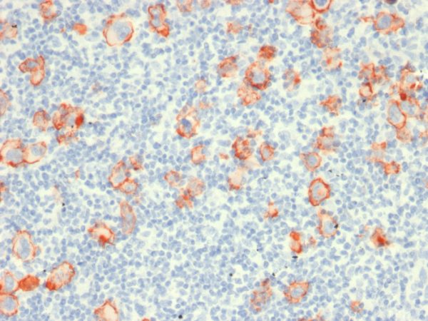 Recombinant CD30 / TNFRSF8 (Hodgkin & Reed-Sternberg Cell Marker) Antibody