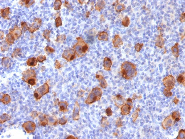 Recombinant CD30 / TNFRSF8 (Hodgkin & Reed-Sternberg Cell Marker) Antibody