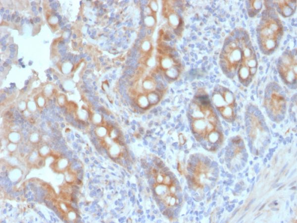 CD33 Antibody in Immunohistochemistry (IHC (P))