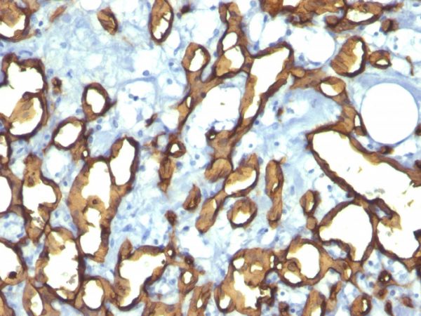 CD34 (Hematopoietic Stem Cell & Endothelial Marker) Antibody