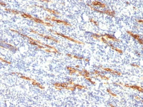 Formalin-fixed, paraffin-embedded human Tonsil stained with CD34 Monoclonal Antibody (QBEnd/10 + HPCA1/763)