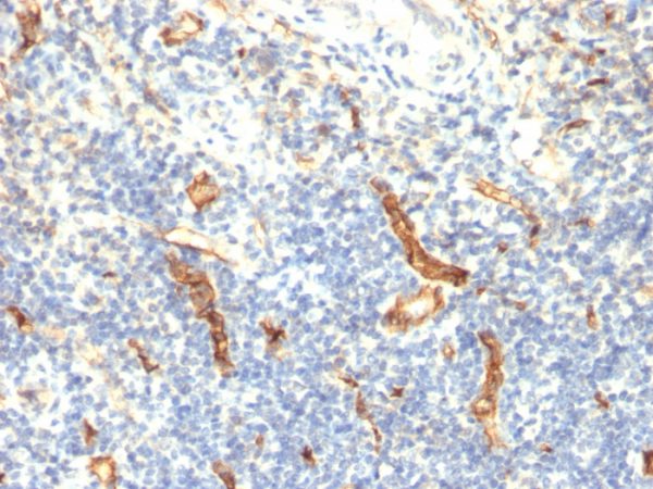 Formalin-fixed, paraffin-embedded human Tonsil stained with CD34 Monoclonal Antibody (HPCA1/1171)