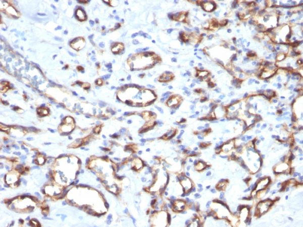 CD34 (Hematopoietic Stem Cell & Endothelial Marker) Antibody