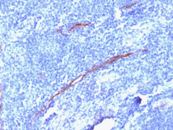 Formalin-fixed, paraffin-embedded human Tonsil stained with CD34 Rabbit Recombinant Monoclonal Antibody (HPCA1/1806R).