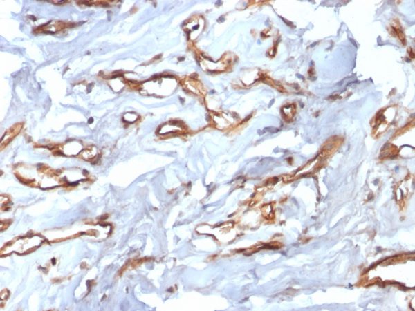 Recombinant CD34 (Hematopoietic Stem Cell & Endothelial Marker) Antibody