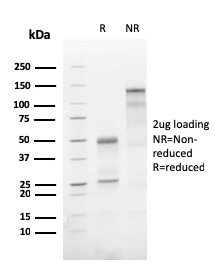 SDS-PAGE Analysis of Purified ATG5 Recombinant Rabbit Monoclonal Antibody (AGT5/3220R). Confirmation of Purity and Integrity of Antibody.