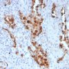 Napsin A (Lung Adenocarcinoma Marker) Antibody - Image 2