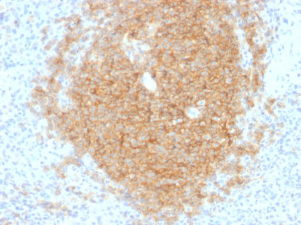 Formalin-fixed, paraffin-embedded human Spleen stained with CD40 Mouse Monoclonal Antibody (C40/1605).