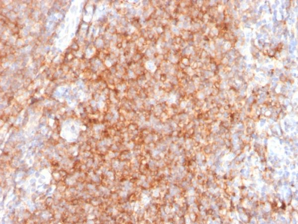 CD40 / TNFRSF5 / CD40L-Receptor Antibody