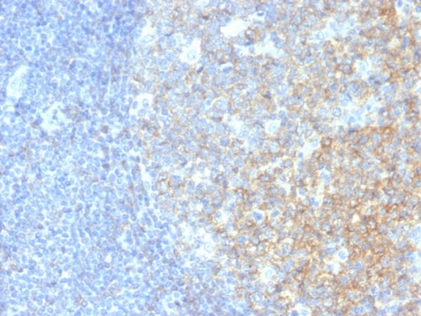 CD40 / TNFRSF5 / CD40L-Receptor Antibody - Image 2