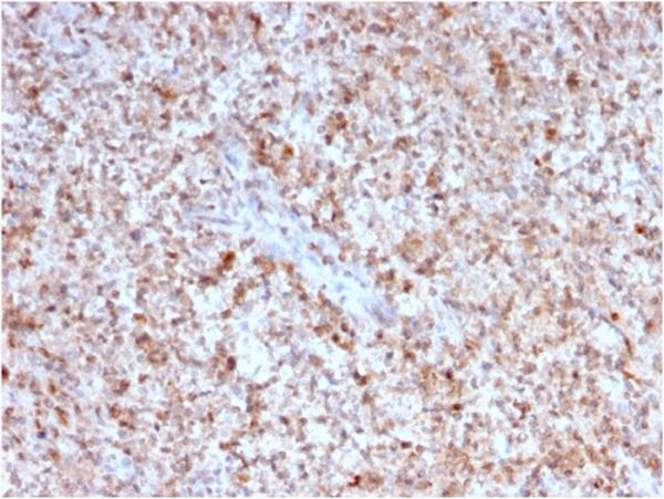 Formalin-fixed, paraffin-embedded human Spleen stained with CD40 Ligand Mouse Monoclonal Antibody (CD40LG/2763).