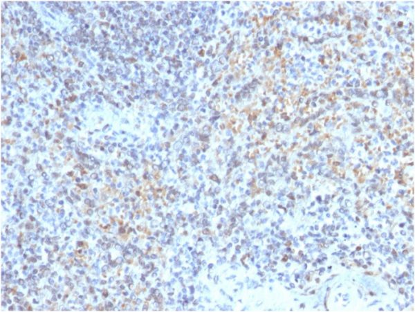 Formalin-fixed, paraffin-embedded human Spleen stained with CD40 Ligand Mouse Monoclonal Antibody (CD40LG/2763).