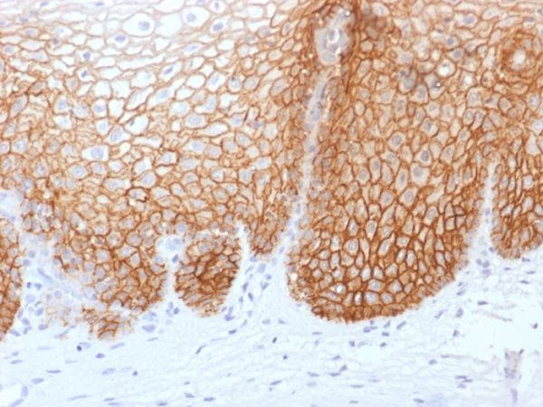 Recombinant CD44v9 (Marker of Tumor Metastasis) Antibody