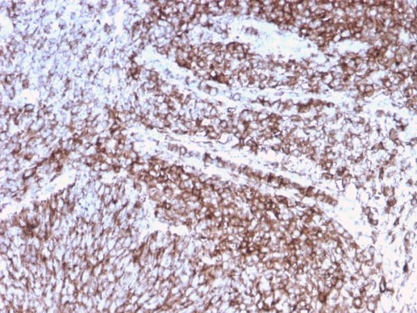 Formalin-fixed, paraffin-embedded human cervix stained with CD44 Recombinant Mouse Monoclonal Antibody (rHCAM/918).