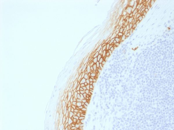 Formalin-fixed, paraffin-embedded human Tonsil stained with CD44v9 Rabbit Recombinant Monoclonal Antibody (CD44v9/2344R).