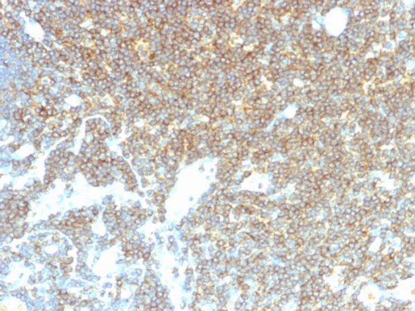 Formalin-fixed, paraffin-embedded human lymph node stained with CD48 Mouse Monoclonal Antibody (CD48/4785).