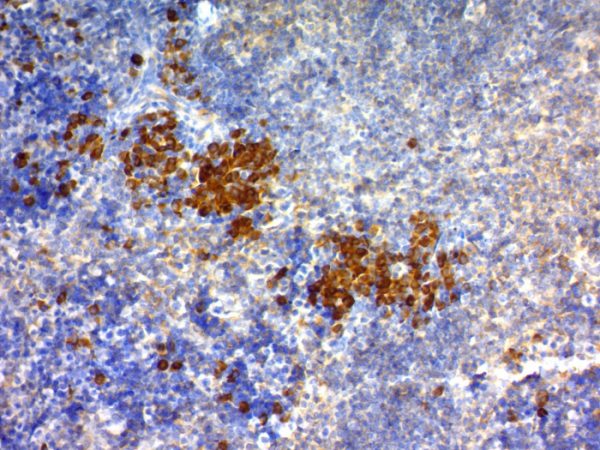 CD63 Antibody in Immunohistochemistry (IHC (P))