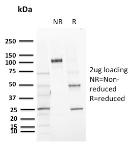 SDS-PAGE Analysis of Purified CD72 Mouse Monoclonal Antibody (BU40). Confirmation of Purity and Integrity of Antibody.